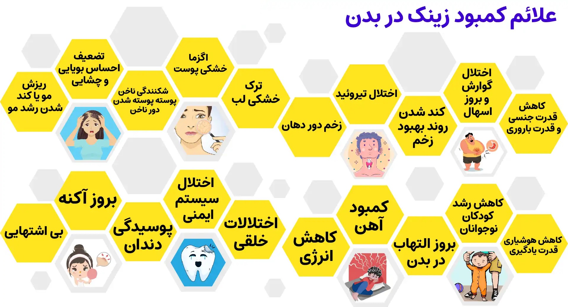 زینک
